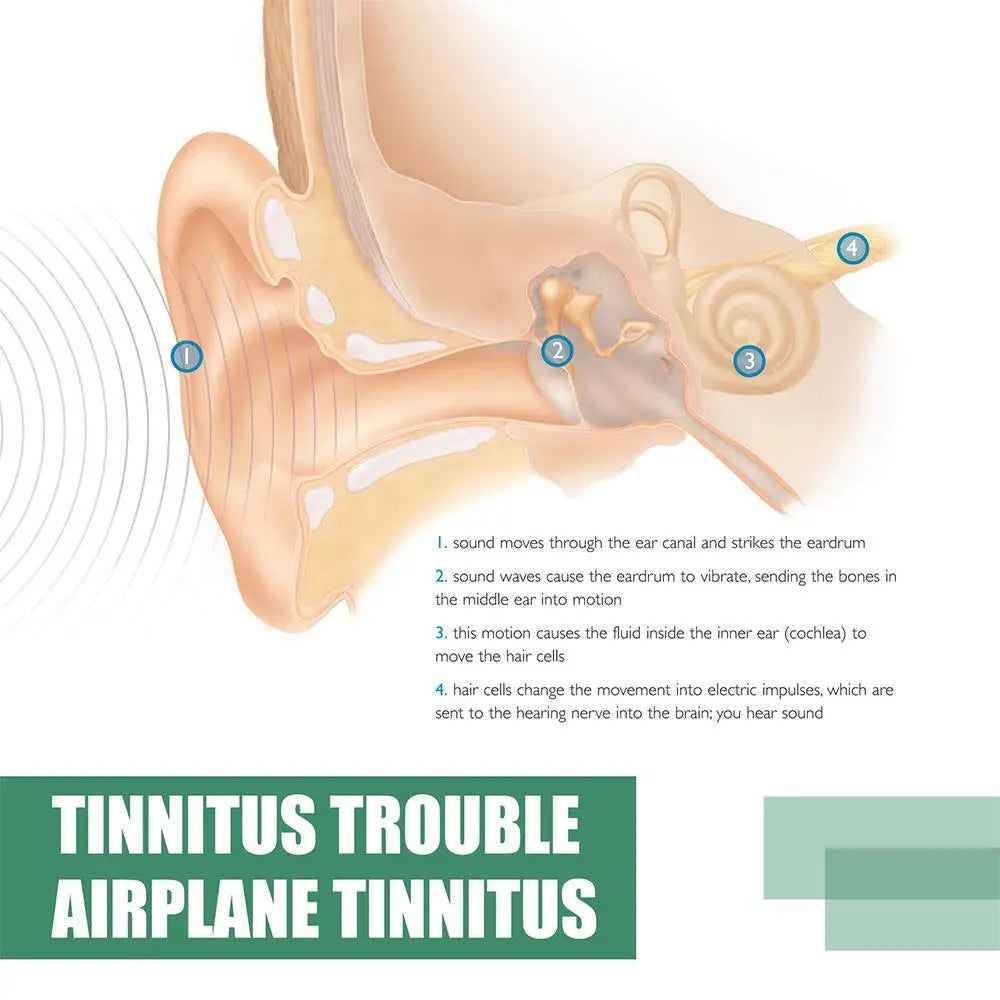 2X Tinnitus Ear Drops Ear Ringing Gentle Relieving Health Discharge Care Tinnitus Fluid Ear Ear Deafness Swelling Otitis Care