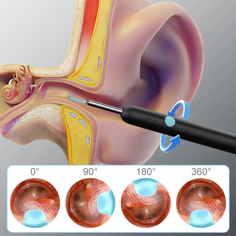 WIFI Visual Ear Sticks HD1080P 4.2MM Mini Camera Ear Pick Ear Spoon Ear Cleaner Wireless Endoscope Health Care Ear Wax Cleaning